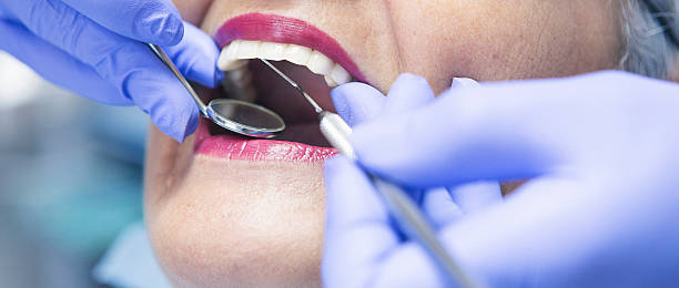 Best Emergency Broken Tooth Repair in Kokomo, IN
